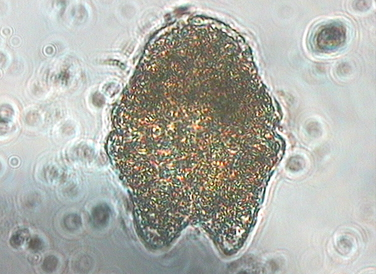 Dictyocha speculum